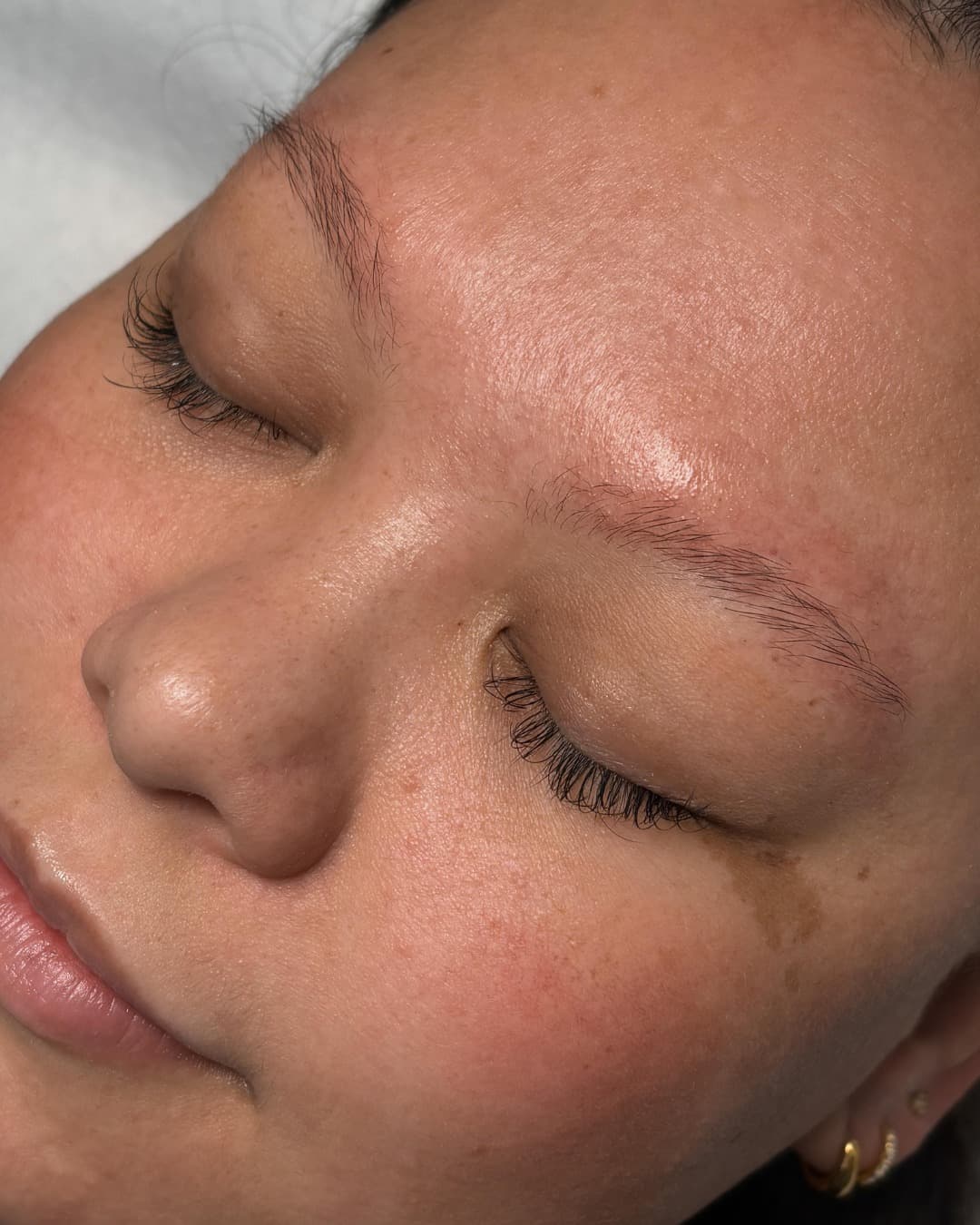 Härchentechnik – Vorher & Nachher Before